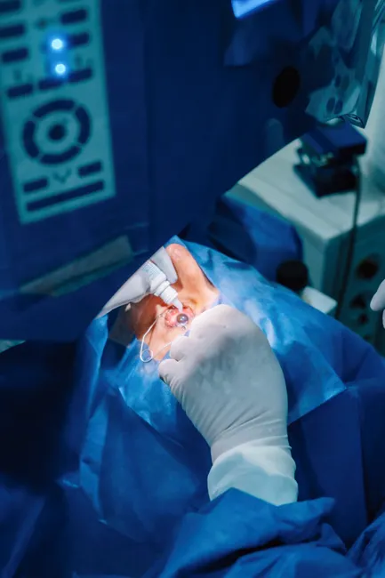 A detailed view of a surgeon performing eye surgery with precision using a microscope in a sterile operating room.